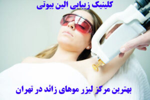 لیزر مو در تهران